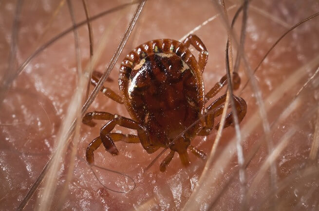 picture of tick biting skin